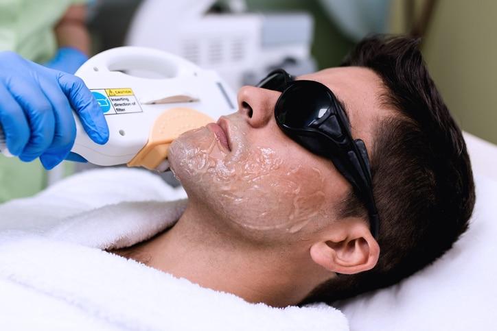 Permanent Laser Hair Removal
